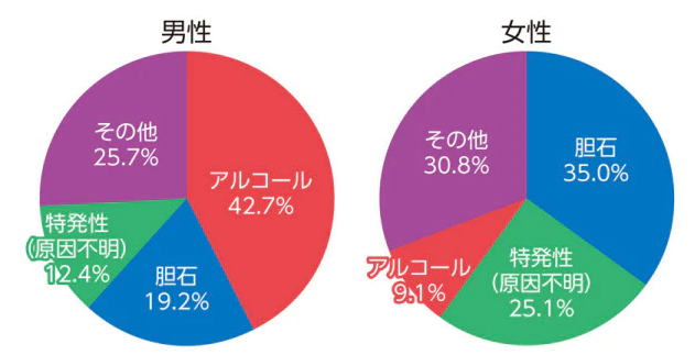 急性膵炎の原因